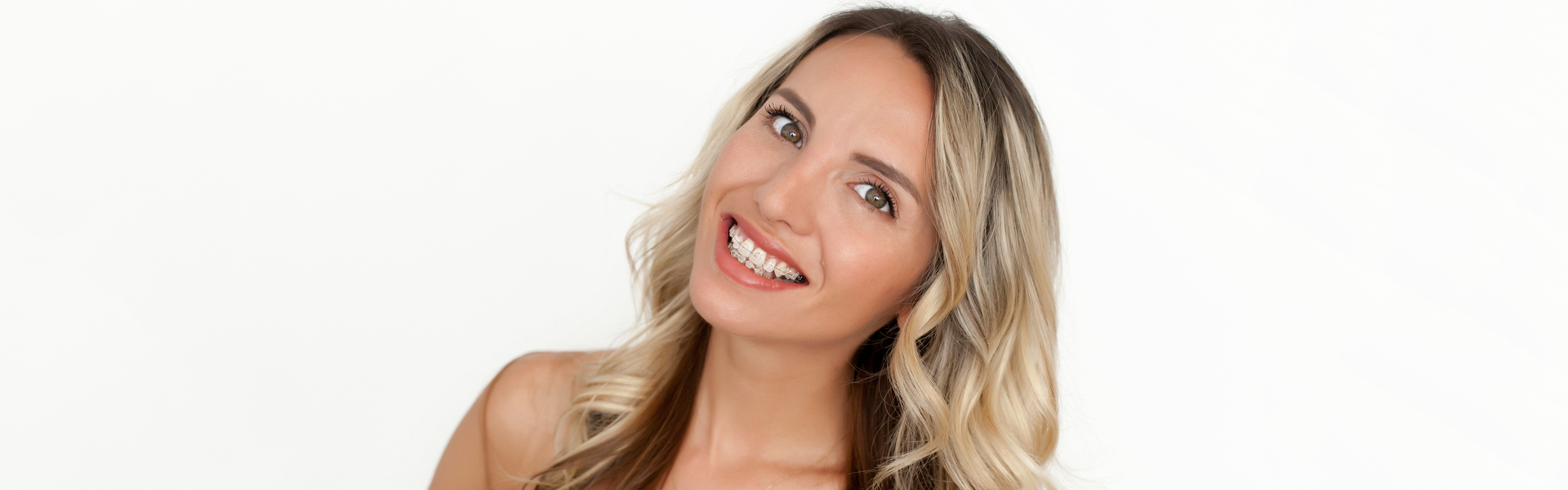 Clear Braces or Invisalign: Which Are Right For You?